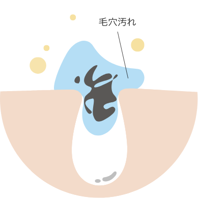 1/3ステップ